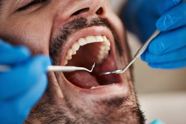 Best Dental Abscess Treatment in Kearney, MO