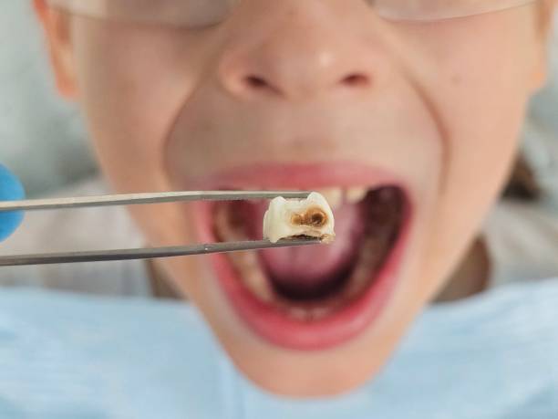 Best Emergency Pediatric Dental Care in Kearney, MO